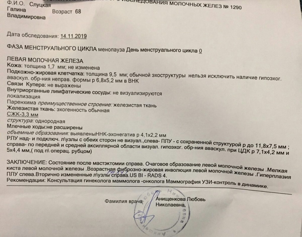 Монитор BENQ вид сзади