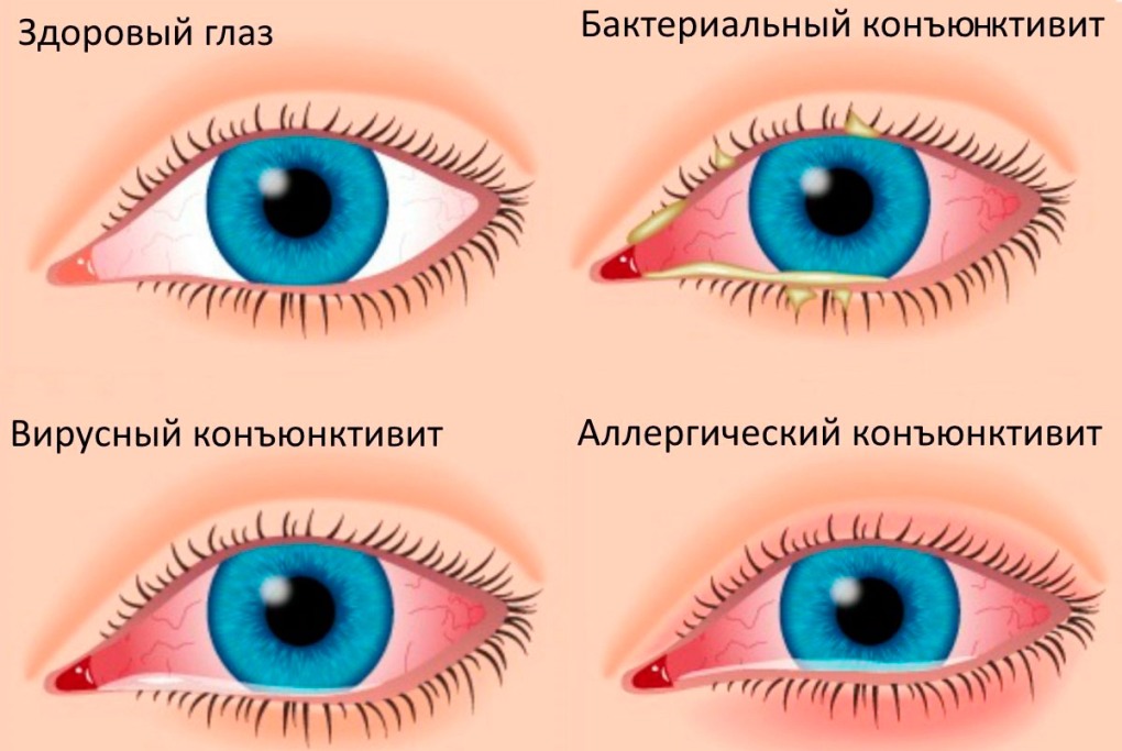 Мы в ответе за тех кого напоили