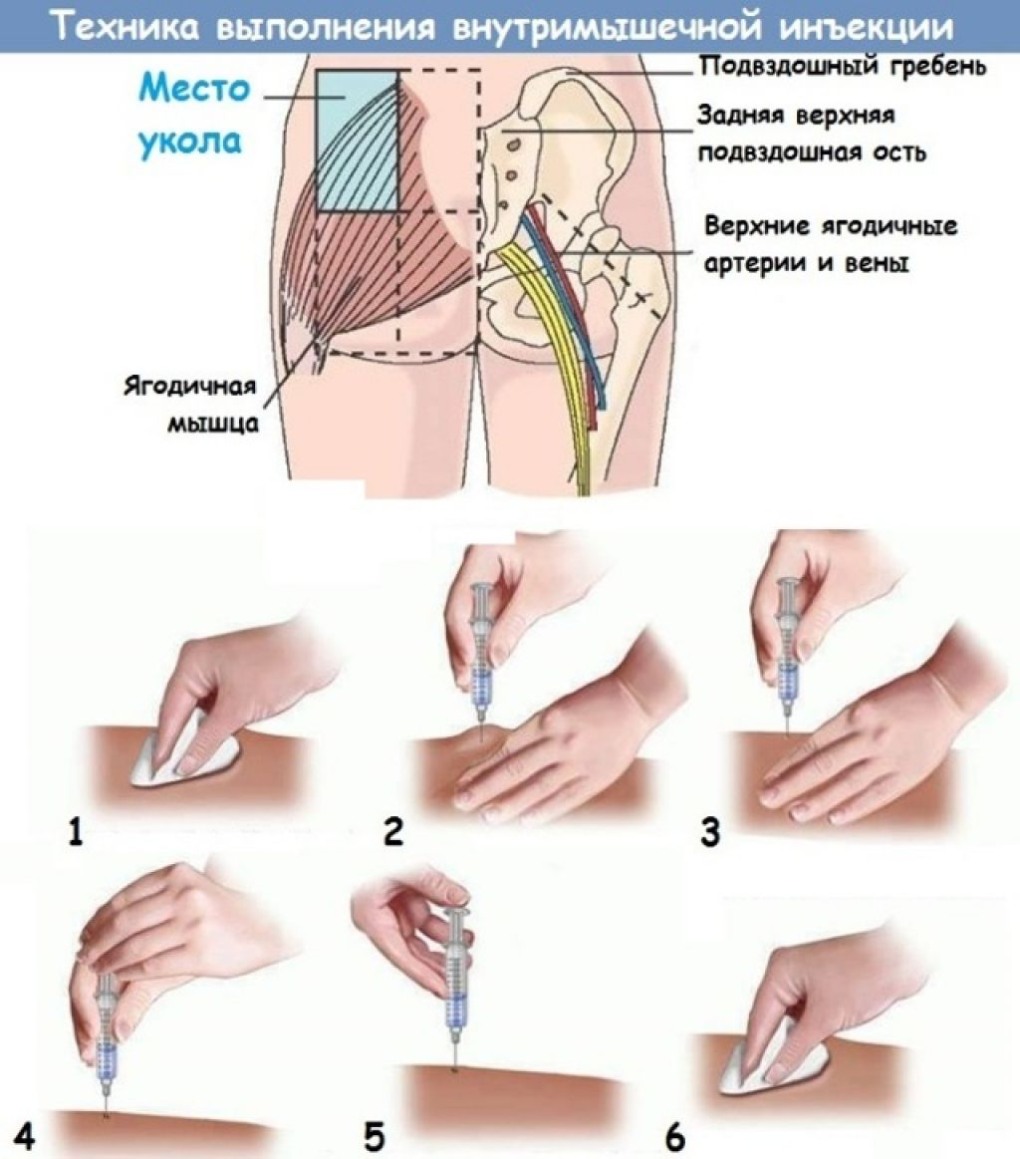 Откровенныеифото Рената Литвинова