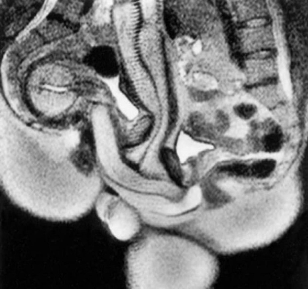 Хентай оплодотворение XRAY pregnant